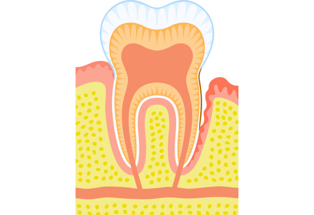 歯周病